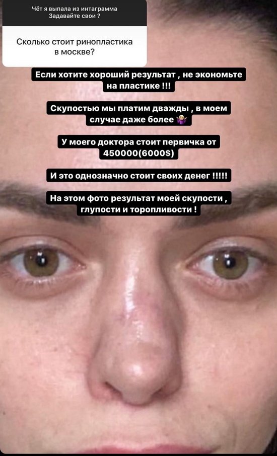  :   !