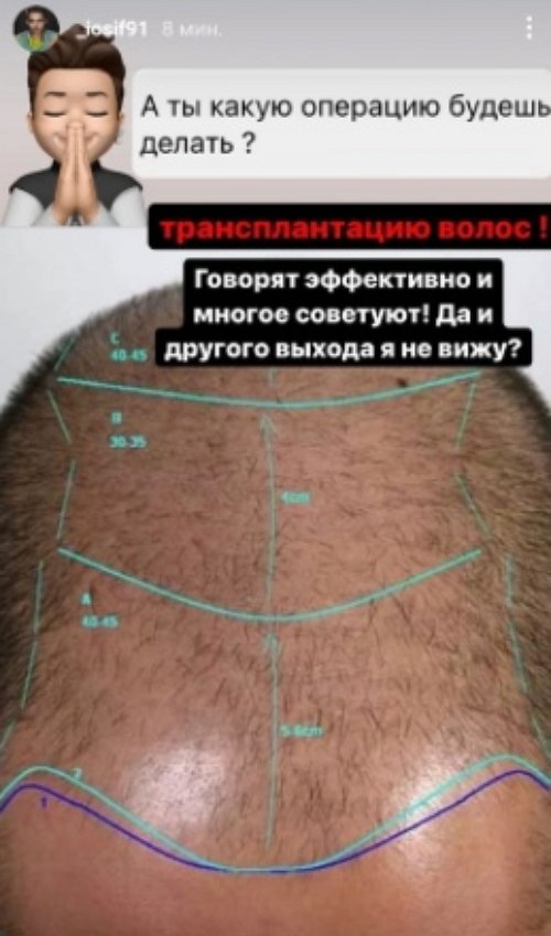  :      