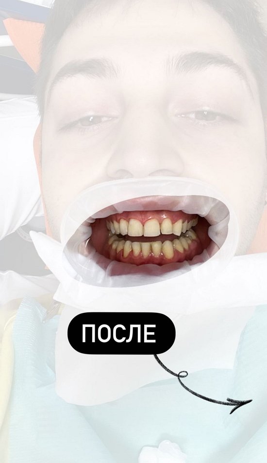  :     !