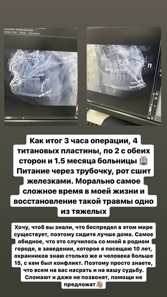  :       