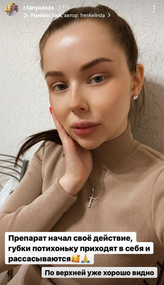  :    