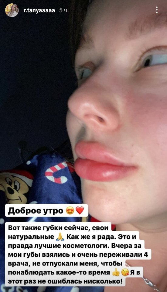  :    