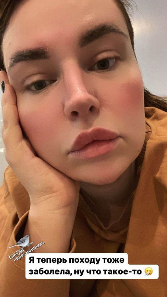  :    ...