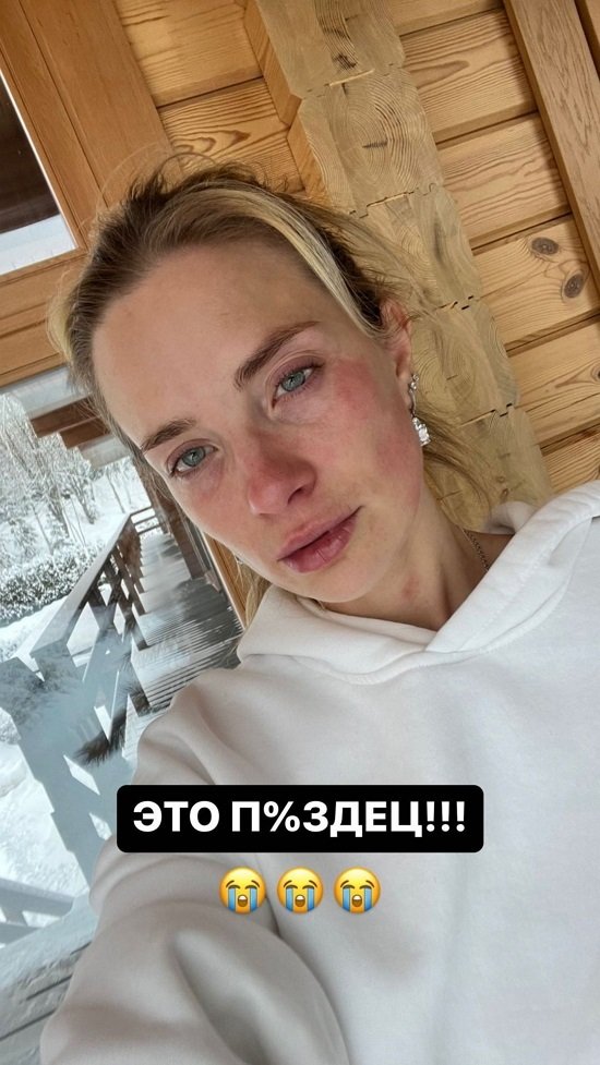  :    ...