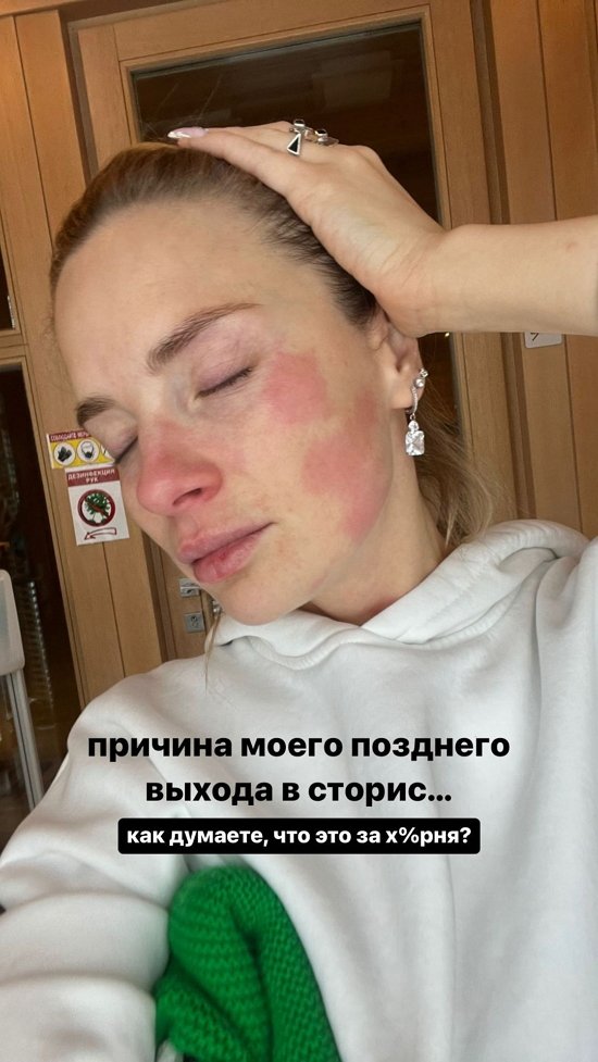  :    ...
