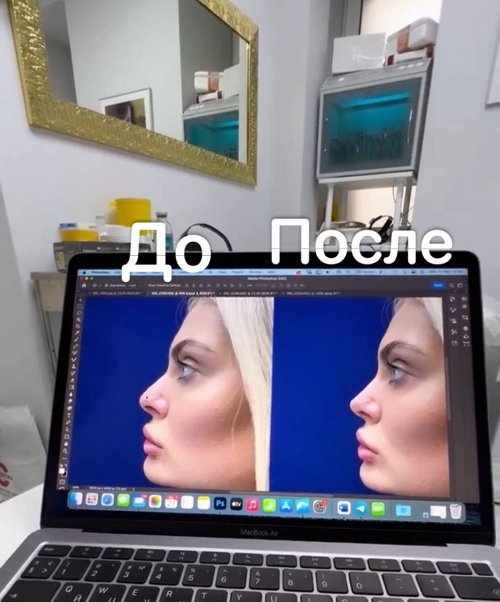 :      
