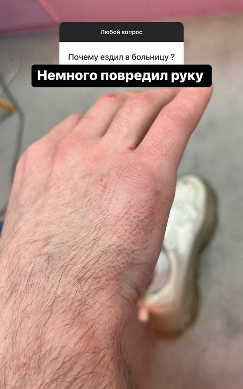  :  !