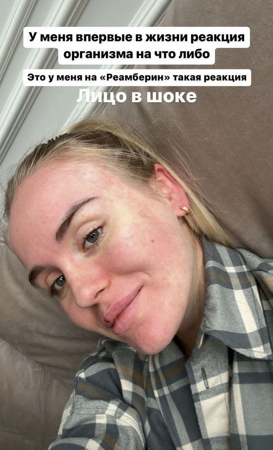  :    ...