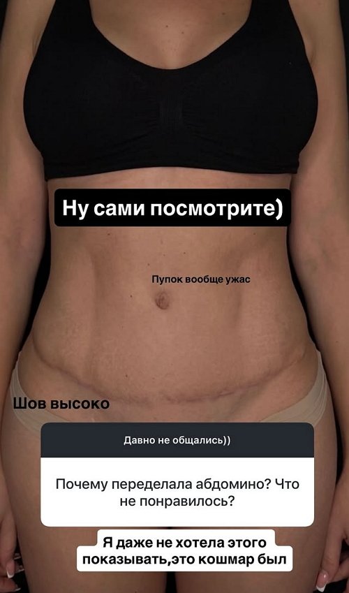 ����� ������: ��� ��� ������