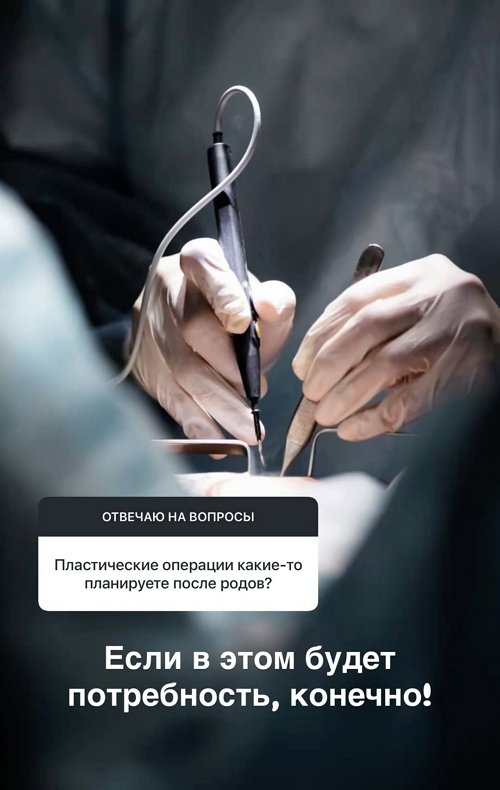 ��������� ��������: ����� ������� - � �� ������